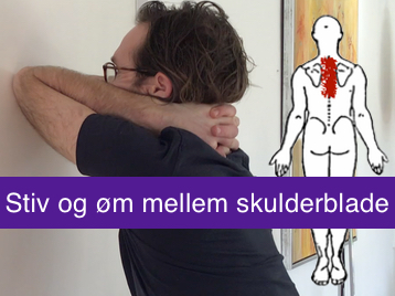 Facetledssyndrom – smerter, stivhed og ømhed mellem skulderbladene