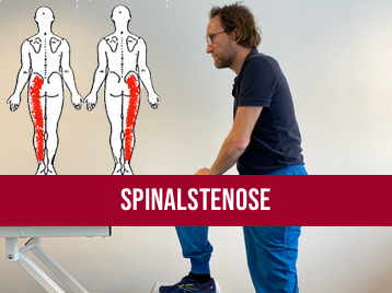 Spinalstenose